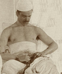The amazing story of dr. Tzaicu- the first surgeon in the world to perform hernia surgery on himself